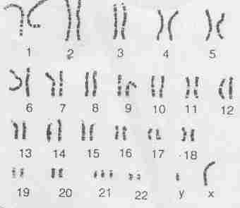 q_chromosome